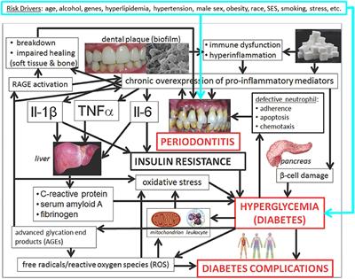 Diabetes and Oral Health: Summary of Current Scientific Evidence for Why Transdisciplinary Collaboration Is Needed